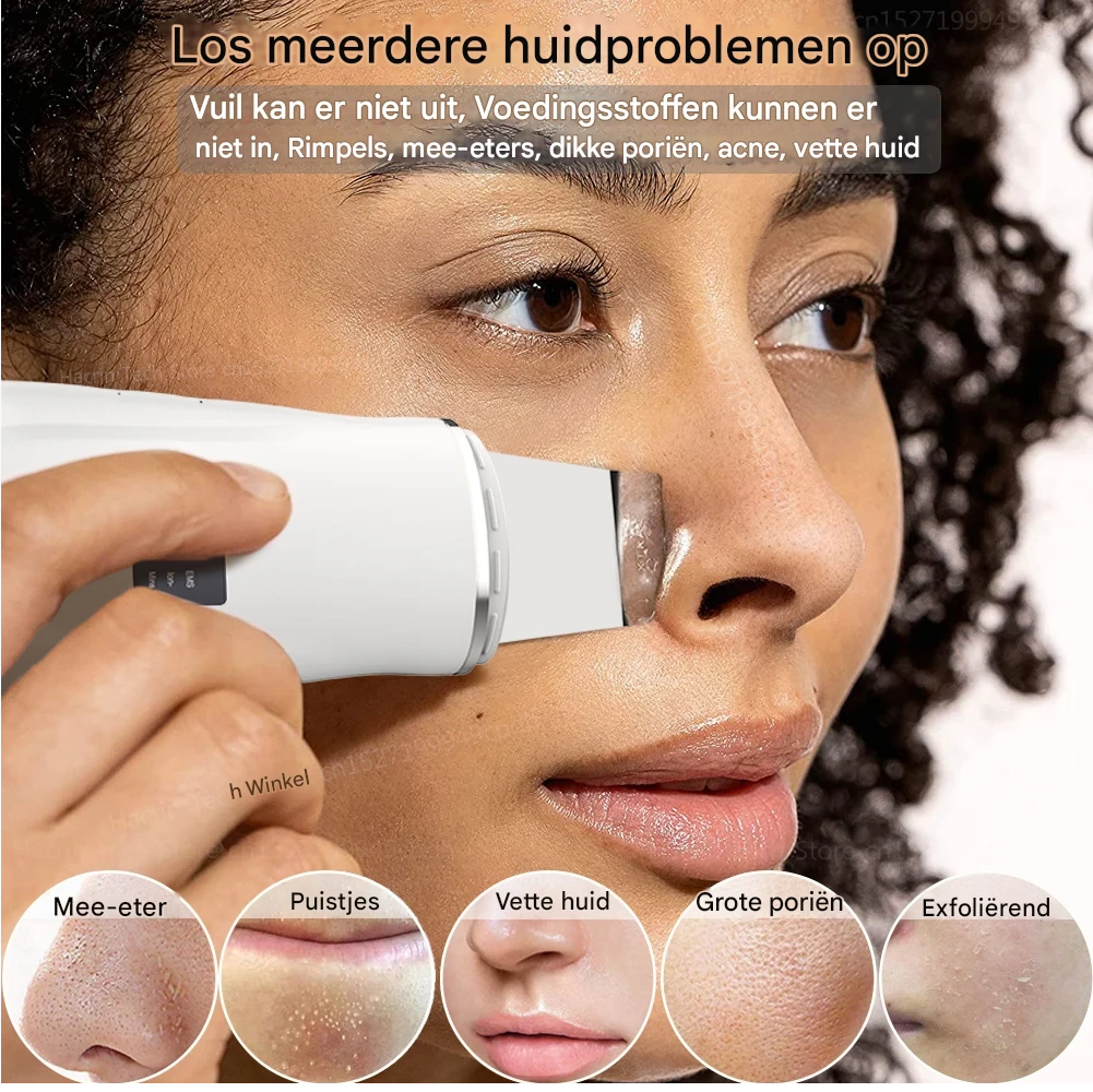 GlowDeep™ 4-in-1 Ultrasone Huidreiniger – Diepe Porie Reiniging, Lifting & Verjonging