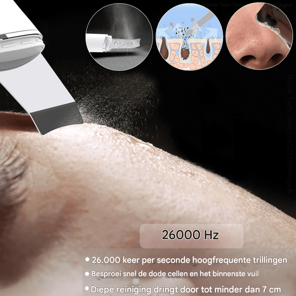 GlowDeep™ 4-in-1 Ultrasone Huidreiniger – Diepe Porie Reiniging, Lifting & Verjonging