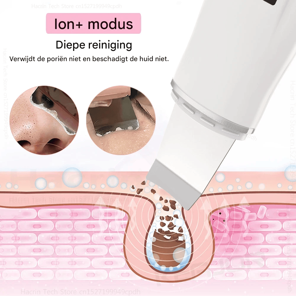 GlowDeep™ 4-in-1 Ultrasone Huidreiniger – Diepe Porie Reiniging, Lifting & Verjonging